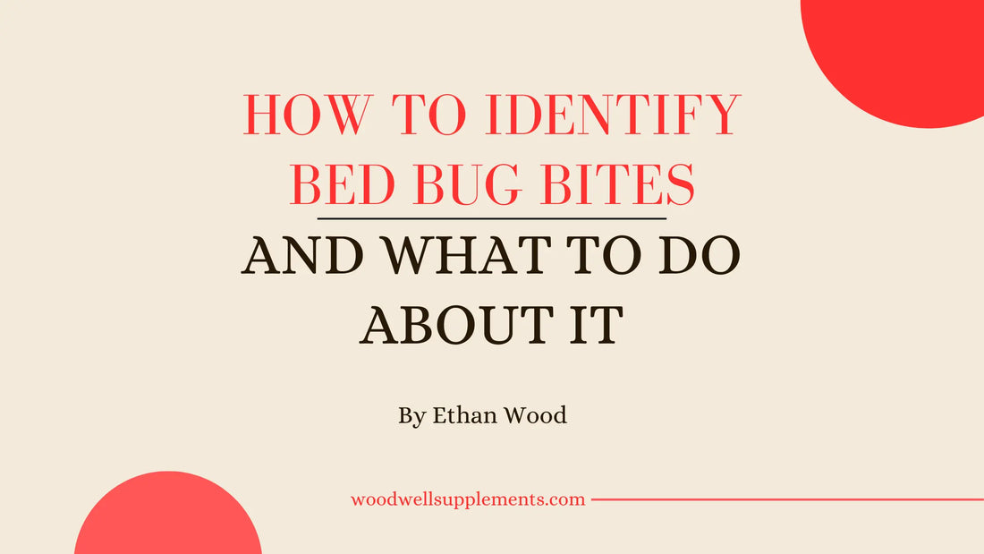 How to Identify the Bite of a Bed Bug